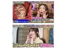 クレセント(CRESCENT)の雰囲気（番組で紹介されました！話題の幹細胞美容REVIハーブピーリング）