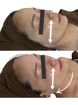 リノン(LIINON)/フェイスラインのもたつき撃退!