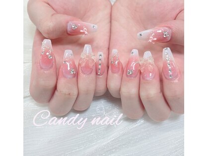 キャンディーネイル(candy nail)の写真