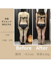 ベルナ(BELUNA)/後ろ姿もすっきりと…。