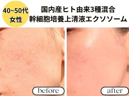 リジェネラティブセル メディカルサロン(Regenerative Cell Medical Salon)の写真