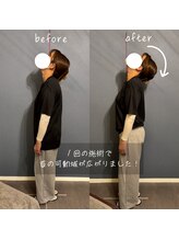 首の休日/【施術変化】1回で首の可動域UP