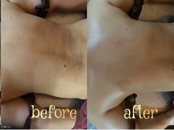 温和活 ロータス(温和活Lotus蓮:)/オイルリンパマッサージ施術変化