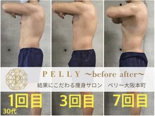 ペリー(PELLY)/男性30代　before after