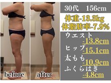 ラ コンシェル 町田店/Before After【町田店】