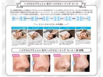 ローズ 門前仲町(Rose)の写真/毛穴の黒ずみ・角栓・開きを徹底ケア！高濃度水素水ハイドロ毛穴洗浄でつるんとなめらかな素肌へ♪