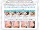 ローズ 門前仲町(Rose)の写真/毛穴の黒ずみ・角栓・開きを徹底ケア！高濃度水素水ハイドロ毛穴洗浄でつるんとなめらかな素肌へ♪