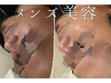 リルビー(Lilby)の雰囲気（男性も、お肌を整える時代♪）