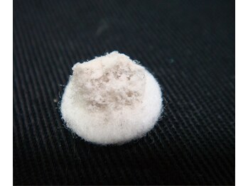 ティーケーエム エンザイム スパ(TKM Enzyme Spa)/ダイヤモンドピール　古い角質