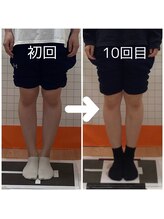 とくしま整体院 藍住院/O脚改善