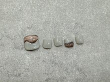 モナリザ 三宮店(MonaLisa)/(( FOOT )) フットコース