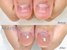 ヘブンリープラス＋ Luz湘南辻堂店/深爪矯正 自爪育成 ネイルケア