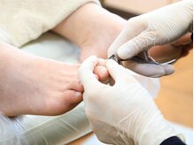 厚木 海老名 巻き爪矯正センターの雰囲気（＜爪切り単品MENUもあり＞痛みの少ない巻き爪ケアで根本改善。）