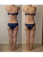 スロウ(THROW)/インディバ　冷え・慢性疲労ケア