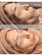 シューラディアント(ShuRadiant)/リジュラン