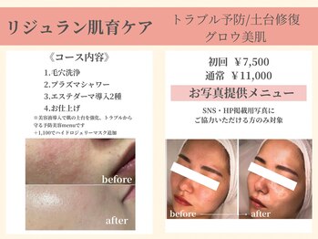 ナーズプラス リベルテ(Naz Plus/Liberte)/リジュラン肌育ケアコース