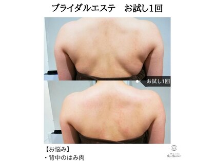 RiとBiのたまごの写真