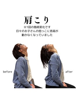 整体院チルアンドママ(CHILL&mama)/肩こり