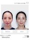 オリノ(Olino)の写真/ハリツヤをUPしたい方へ。ほうれい線やゆるみもしっかりアプローチ★結果重視サロン！！