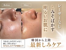 マヌレニ(manuleni)の雰囲気（まんまるおでこは若さの象徴！おでこのシワが気になる方にも）