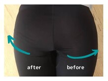 りもあず(ReMore-S)/子宮ポカポカ骨盤矯正