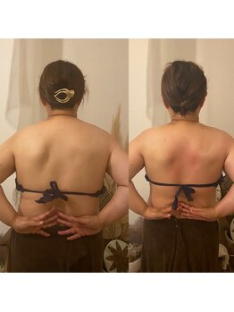 ソバニ(SOBANI)/肩甲骨剥がし