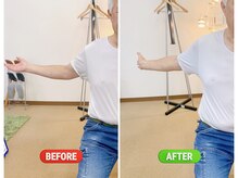 ニコ(niko)/初回で50肩が楽に　５0代　男性