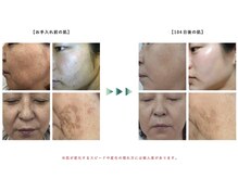 ドクターアイビューティーラボ 溝の口店(Dr. i BEAUTY LABO)の雰囲気（ハーブピーリング、ララピール、ガリレオピーリングなど多数施術）