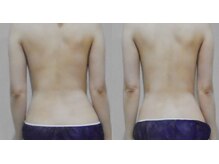 アルマ 芦屋(ALMA)/部分ケアもお任せ下さい！