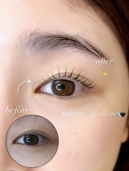 ノエル(Noel)/before→after 　担当なぎ