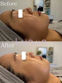 ルノン(Lunon)/ララピール