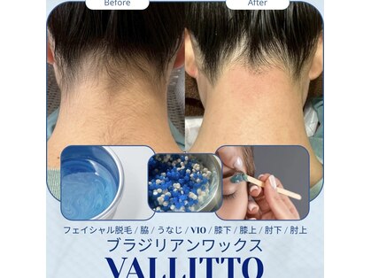 オーガスター(ORGASTAR)の写真