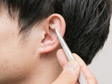 ダイエット痩身センター 能見台店の雰囲気（金粒というビーズ状の玉をテープで固定し耳つぼを刺激します。 ）