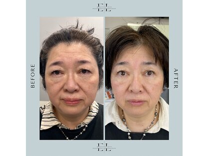 ソエルテの写真