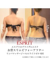 エスプリ 新宿店/天使の羽・ブライダルエステ新宿