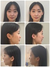 ブルーミングデイズ(blooming days)/憧れのフェイスの第一歩♪