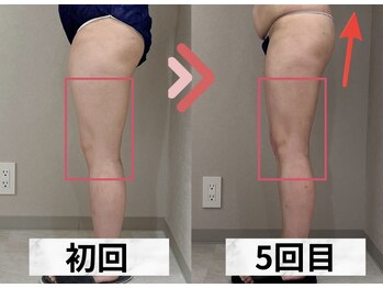 イヨヨ(iyoyo)/【痩身】Before After