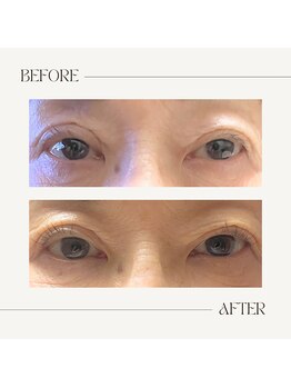 マーブル(marble)/お客様写真