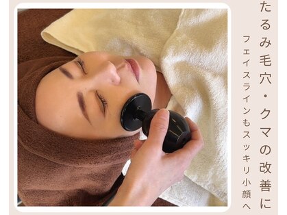 アールビーシー(RbC)の写真