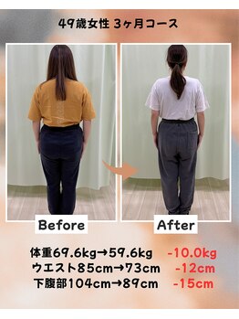 くさば整骨院/49歳女性/ダイエット3か月コース