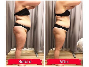 ビトタン 倉敷本店(+美to鍛)/段々と脂肪が付き、痩せない。