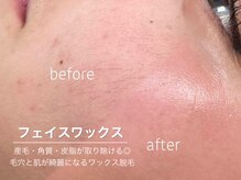 ハリウッドブロウリフトワクシー 渋谷(HOLLYWOODBROWLIFT WAXYYY.)/肌が綺麗になるワックス脱毛