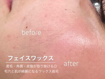 ハリウッドブロウリフトワクシー 渋谷(HOLLYWOODBROWLIFT WAXYYY.)/肌が綺麗になるワックス脱毛