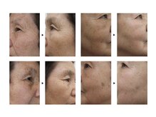 エステサロンパリス(Esthe Salon Paris)の雰囲気(ノンリアクションのフェイシャルでニキビケア・しみしわ肌質改善)