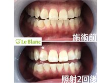 ルブラン 奈良店(Le Blanc)/誰もが憧れませんか！？