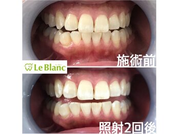 ルブラン 奈良店(Le Blanc)/誰もが憧れませんか!?