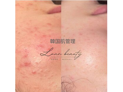 ルアンビューティー メディカルプラス(Luan beauty MEDICAL+)の写真