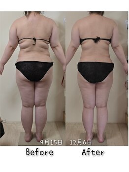 ラエッセス(A Laessess)/3ヶ月後でここまで変わる