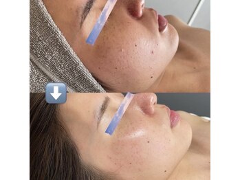 リツイート(ReTweet)/医療提携 三か月服用