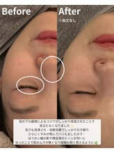 ニコ(nico)/グッバイ鼻の黒ずみ・目元の小皺